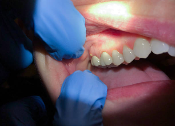 Best Pediatric Emergency Dentist in Blauvelt, NY